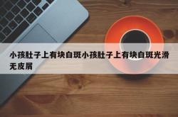 小孩肚子上有块白斑小孩肚子上有块白斑光滑无皮屑