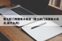 婴儿肛门周围有小白点（婴儿肛门周围有小白点,搽什么药）